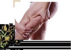 Understanding the Causes of Cellulite Formation – Expert Guidance from Akaraby Aayna