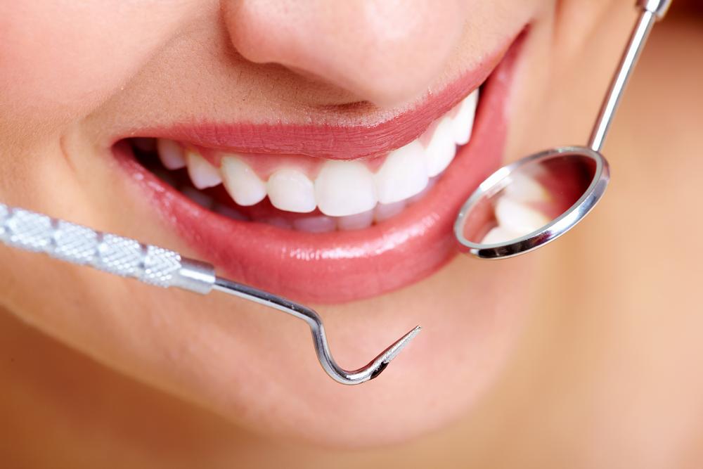 Joondalup Cosmetic Dentistry FAQs: What Locals Ask Most