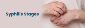 Can Doxycycline 100mg Cure Syphilis?