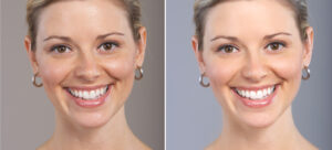 Skin Lightening Treatment in Delhi: Expert Solutions from Medlinks & Top Dermatologists in Gurgaon