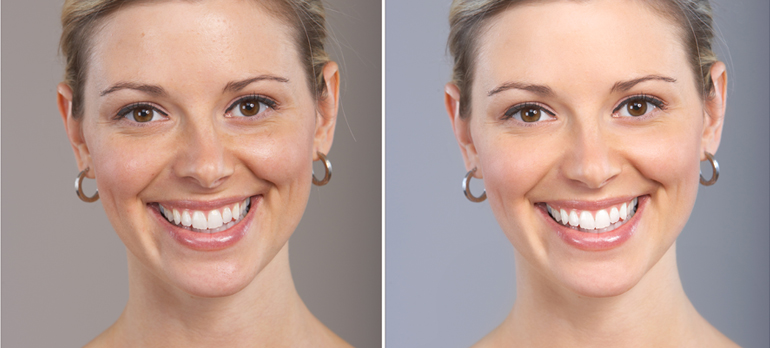 Skin Lightening Treatment in Delhi: Expert Solutions from Medlinks & Top Dermatologists in Gurgaon