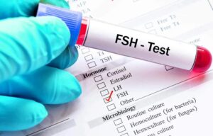 FSH Test: An Essential Hormonal Check for Fertility and Reproductive Health