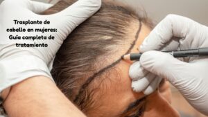 Trasplante de cabello en mujeres: Guía completa de tratamiento