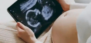 What to Expect During a 5 Weeks Pregnant Sonogram Near Me?