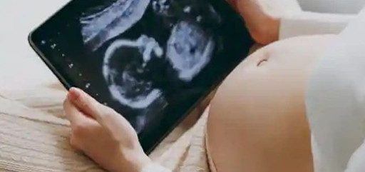 What to Expect During a 5 Weeks Pregnant Sonogram Near Me?