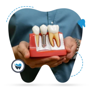 Why Choosing The Right Dentist Matters In Dental Emergency Perth?