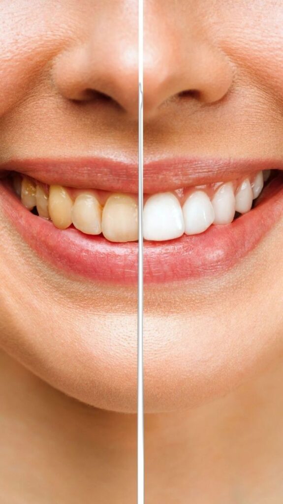Dentpure