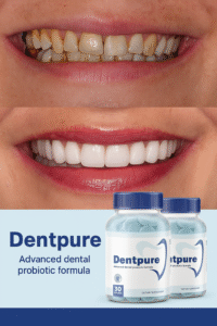 Dentpure – Probiotic Support for Healthy Teeth & Gums